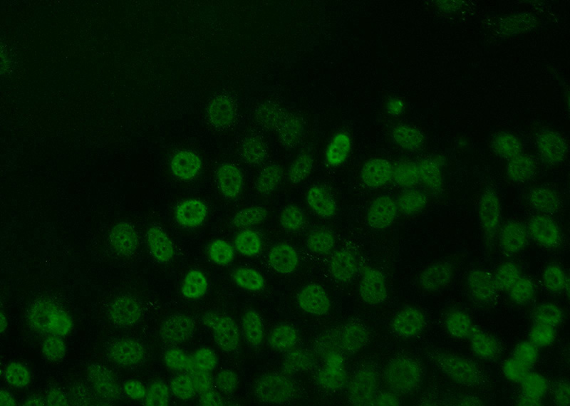 Immunofluorescent analysis of MCF-7 cells using Catalog No:111900(JUNB Antibody) at dilution of 1:25 and Alexa Fluor 488-congugated AffiniPure Goat Anti-Rabbit IgG(H+L)