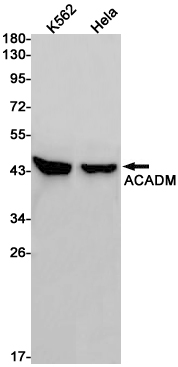 Western blot detection of ACADM in K562,Hela cell lysates using ACADM Rabbit pAb(1:1000 diluted).Predicted band size:47kDa.Observed band size:45kDa.