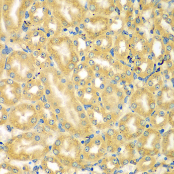 Immunohistochemistry - MOCS3 Polyclonal Antibody 