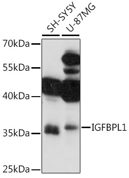 Western blot - IGFBPL1 Polyclonal Antibody 