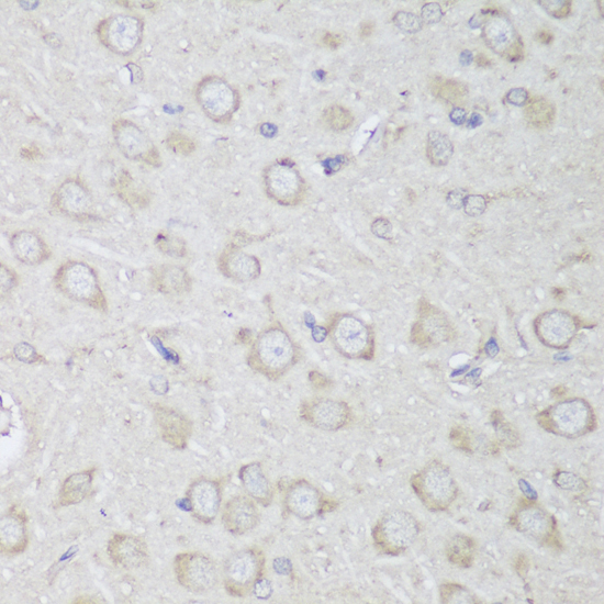 Immunohistochemistry - GANAB Polyclonal Antibody 