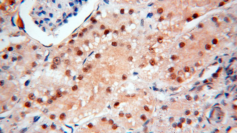 Immunohistochemical of paraffin-embedded human kidney using Catalog No:108104(ANP32A antibody) at dilution of 1:100 (under 40x lens)