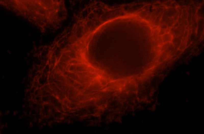Immunofluorescent analysis of HepG2 cells, using GSTT2B antibody Catalog No:111194 at 1:25 dilution and Rhodamine-labeled goat anti-rabbit IgG (red).