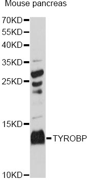 Western blot - TYROBP Polyclonal Antibody 