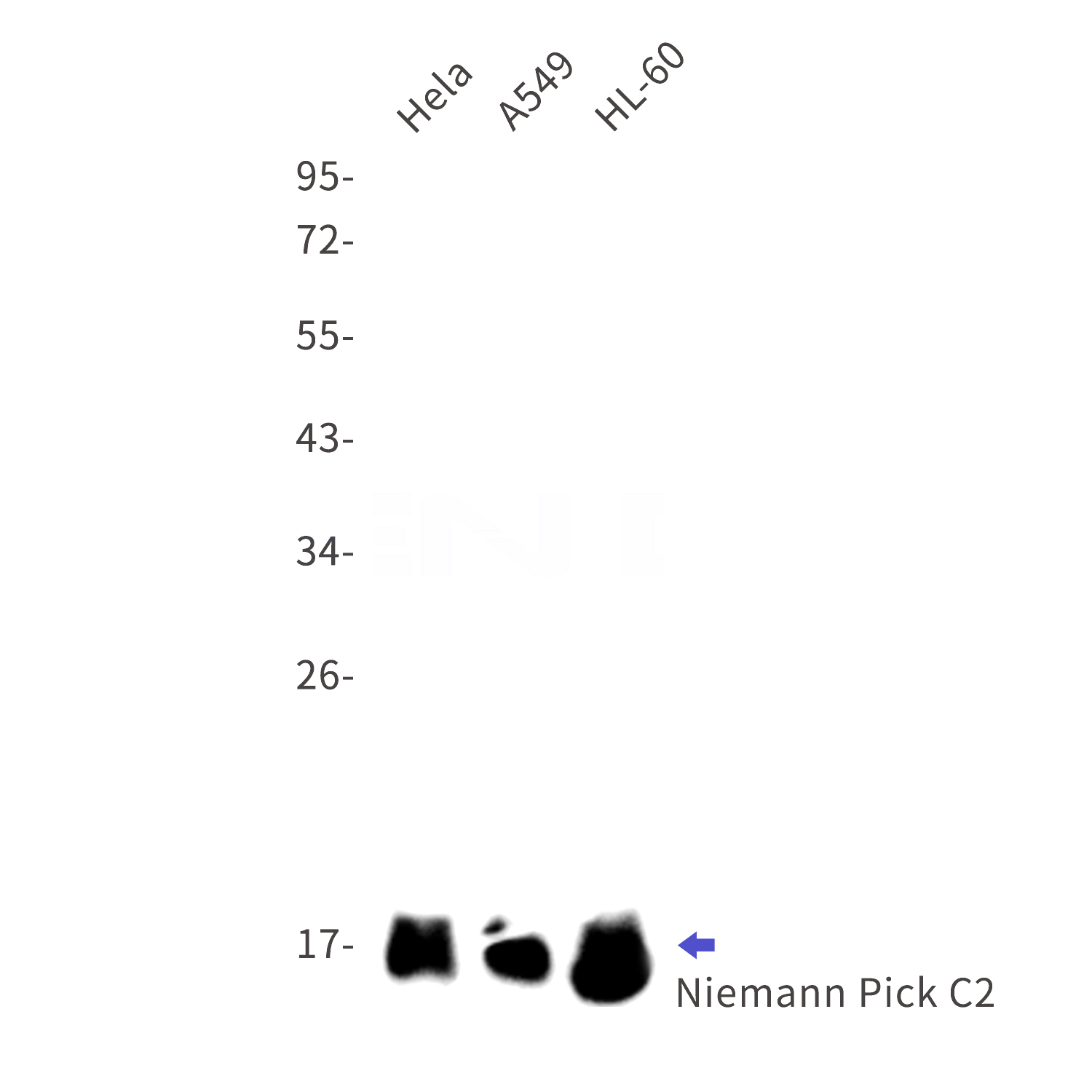 Western blot detection of Niemann Pick C2 in Hela,A549,HL-60 cell lysates using Niemann Pick C2 Rabbit mAb(1:1000 diluted).Predicted band size:17kDa.Observed band size:17kDa.