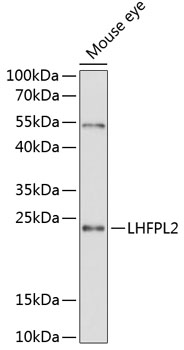 Western blot - LHFPL2 Polyclonal Antibody 