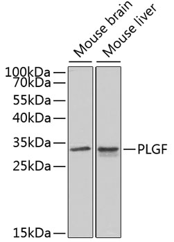 Western blot - PLGF Polyclonal Antibody 