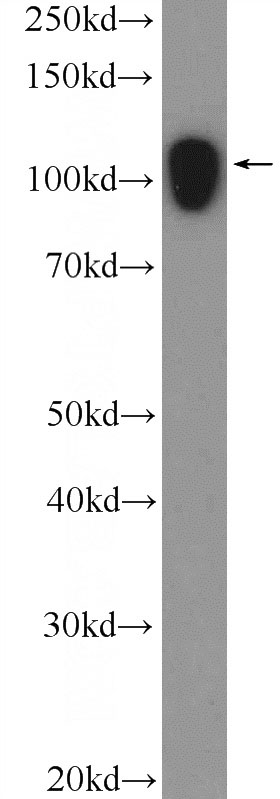 rat brain tissue were subjected to SDS PAGE followed by western blot with Catalog No:107902(AFAP1 Antibody) at dilution of 1:1000