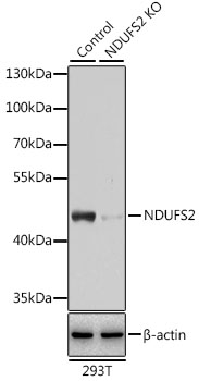 Western blot - NDUFS2 Polyclonal Antibody 