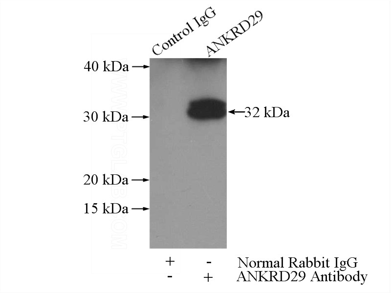 IP Result of anti-ANKRD29 (IP:Catalog No:108074, 3ug; Detection:Catalog No:108074 1:300) with mouse brain tissue lysate 2640ug.