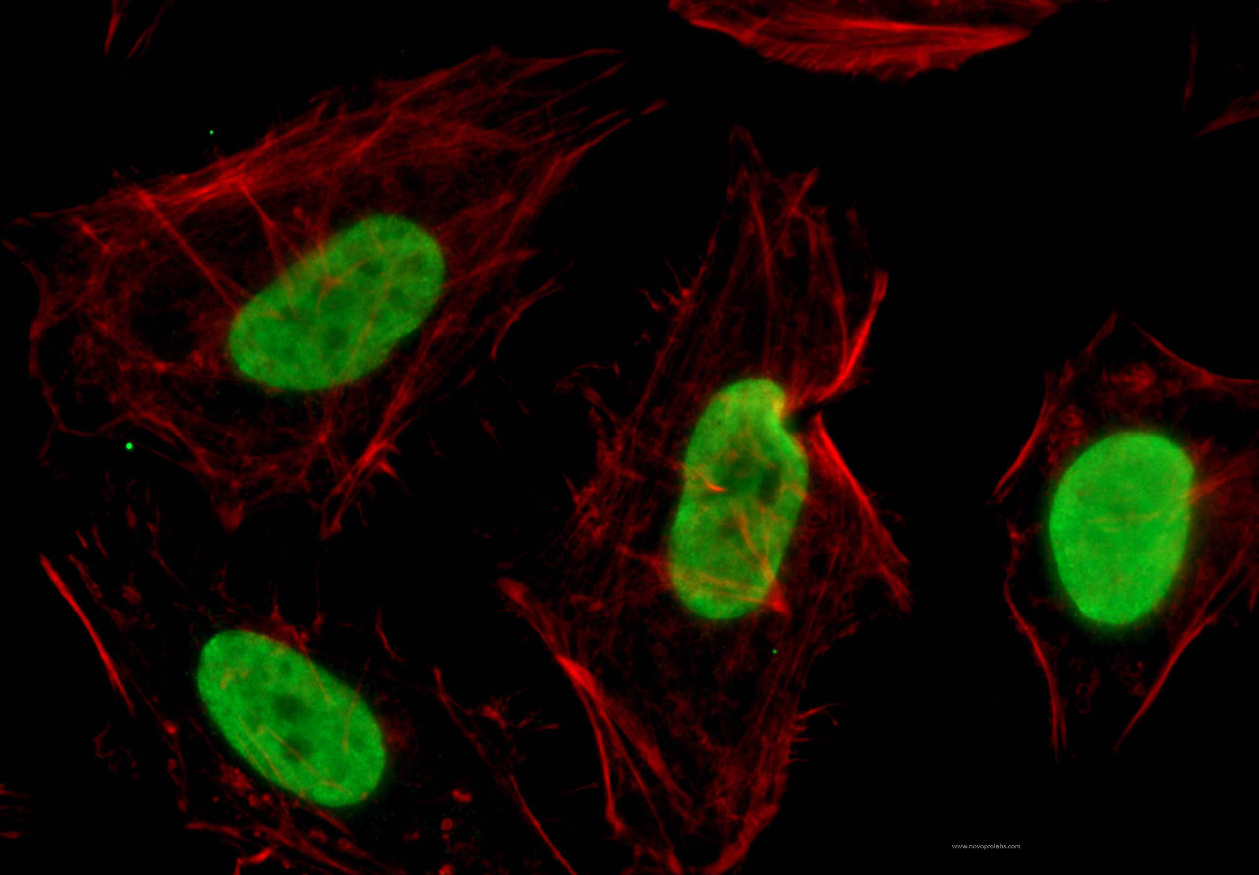 Immunofluorescent analysis of (10% Formaldehyde) fixed MDCK cells using (Pan Acetylation Antibody) at dilution of 1:150 and Alexa Fluor 488-congugated AffiniPure Goat Anti-Mouse IgG(H+L)