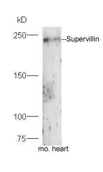 Fig1: Protein: mouse heart lysate;; Primary: rabbit Anti-Supervillin at 1:300;; Secondary: HRP conjugated Goat-Anti-rabbit IgG(bs-0295G-HRP) at 1: 5000;; Predicted band size:248 kD; Observed band size:248 kD