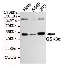 Western blot analysis of extracts from 293,Hela and A549 cells using GSK3u03b1 (Ab-21) rabbit pAb (1:1000 diluted).Predicted band size: 51KDa.Observed band size: 51KDa.