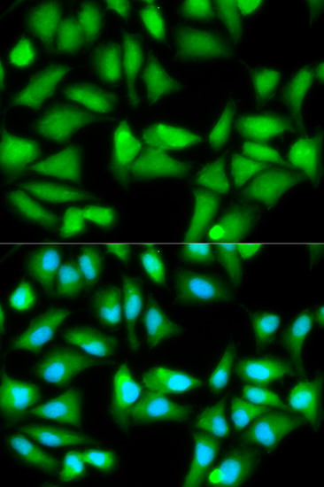 Immunofluorescence - GSS Polyclonal Antibody 