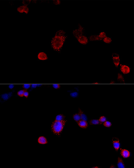 Immunofluorescence - FLNB Polyclonal Antibody 