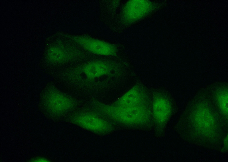 Immunofluorescent analysis of (10% Formaldehyde) fixed A549 cells using Catalog No:111439(HOXD13 Antibody) at dilution of 1:50 and Alexa Fluor 488-congugated AffiniPure Goat Anti-Rabbit IgG(H+L)