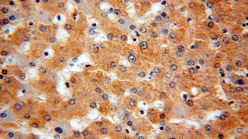 Immunohistochemical of paraffin-embedded human liver using Catalog No:111640(NFKBIA antibody) at dilution of 1:100 (under 40x lens)