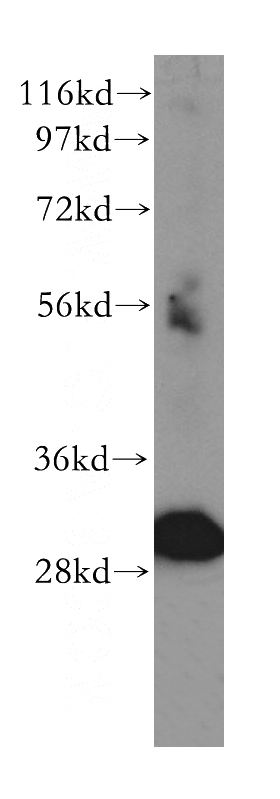 PC-3 cells were subjected to SDS PAGE followed by western blot with Catalog No:116167(TOLLIP antibody) at dilution of 1:500