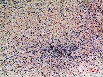 Fig2:; Immunohistochemical analysis of paraffin-embedded human-liver, antibody was diluted at 1:100