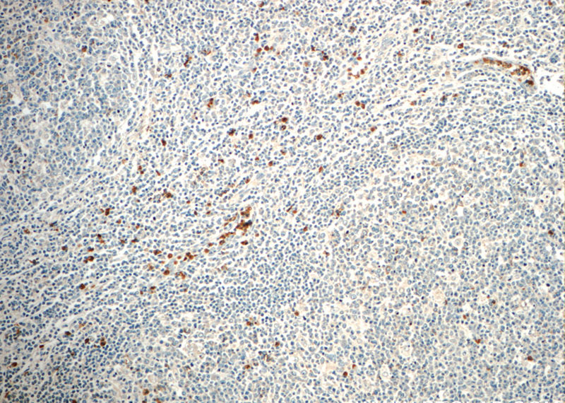 Immunohistochemistry of paraffin-embedded human tonsillitis slide using Catalog No:110601(FAM78A Antibody) at dilution of 1:50