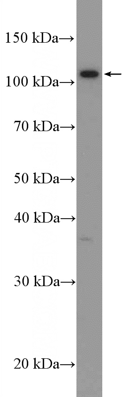 mouse brain tissue were subjected to SDS PAGE followed by western blot with Catalog No:108761(CACNA2D3 Antibody) at dilution of 1:300