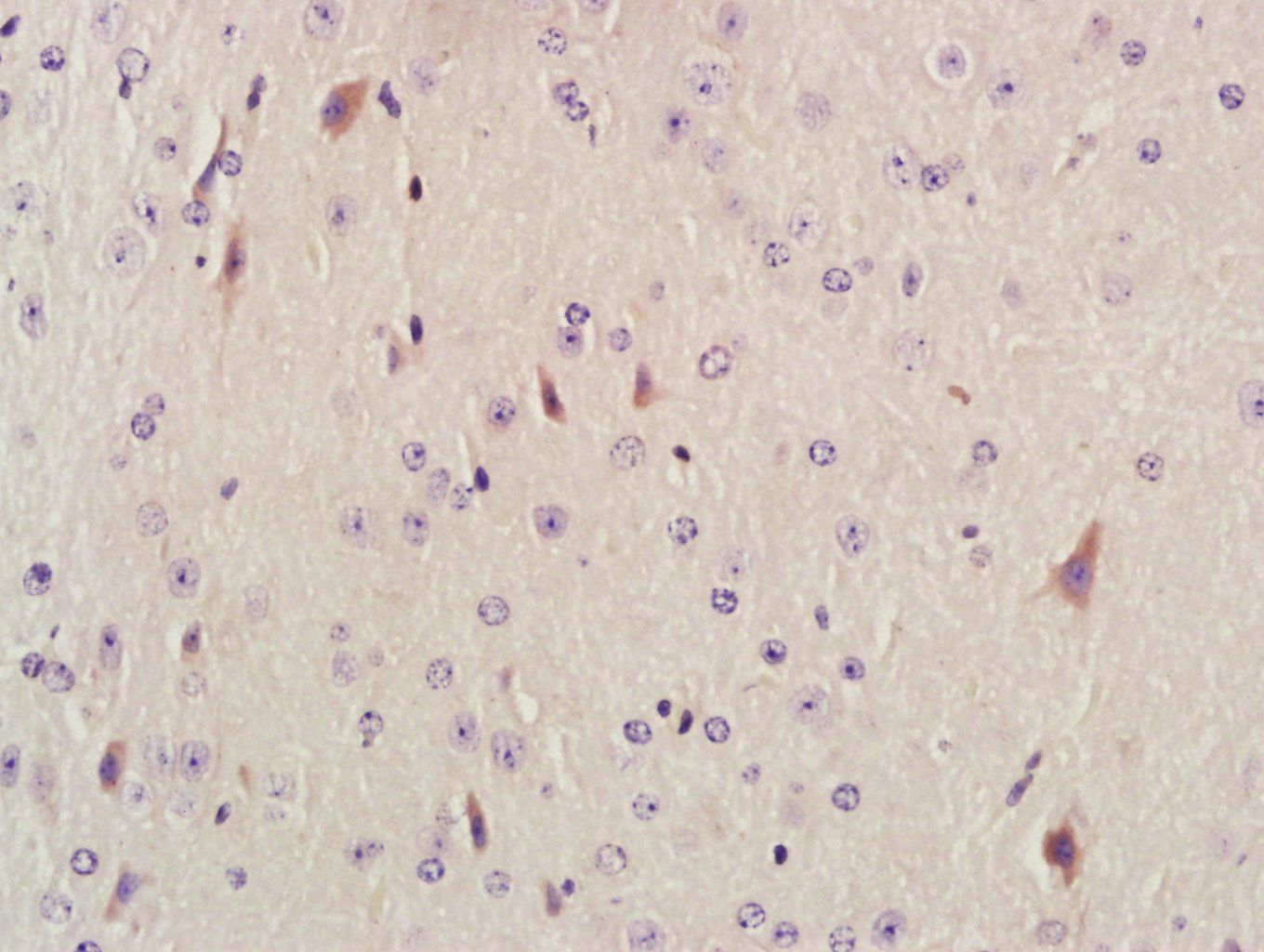 Fig2: Paraformaldehyde-fixed, paraffin embedded (Mouse brain); Antigen retrieval by boiling in sodium citrate buffer (pH6.0) for 15min; Block endogenous peroxidase by 3% hydrogen peroxide for 20 minutes; Blocking buffer (normal goat serum) at 37℃ for 30min; Antibody incubation with (AKAP12) Polyclonal Antibody, Unconjugated at 1:400 overnight at 4℃, followed by a conjugated secondary antibody (sp-0023) for 20 minutes and DAB staining.
