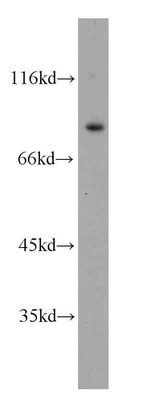 mouse testis tissue were subjected to SDS PAGE followed by western blot with Catalog No:113325(ODF2 antibody) at dilution of 1:500