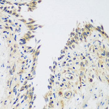 Immunohistochemistry - UPF2 Polyclonal Antibody 