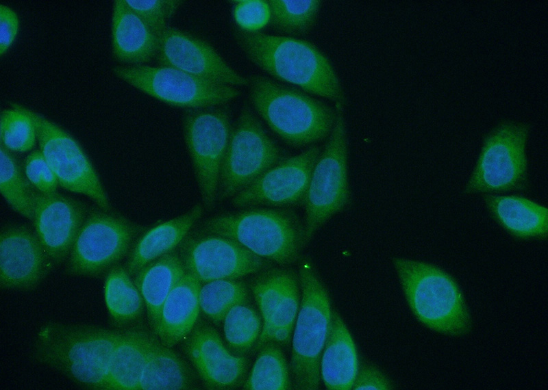 Immunofluorescent analysis of (10% Formaldehyde) fixed HeLa cells using Catalog No:107979(ALG1 Antibody) at dilution of 1:50 and Alexa Fluor 488-congugated AffiniPure Goat Anti-Rabbit IgG(H+L)