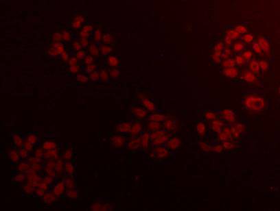 Fig1: ICC staining CCDC111 in HepG2 cells(red). Cells were fixed in paraformaldehyde, permeabilised with 0.25% Triton X100/PBS.