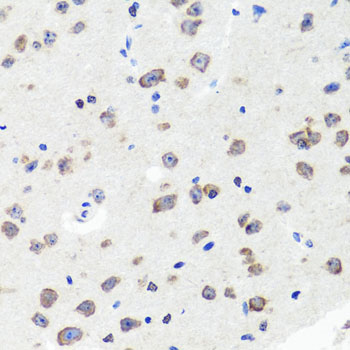 Immunohistochemistry - DLG1 Polyclonal Antibody 