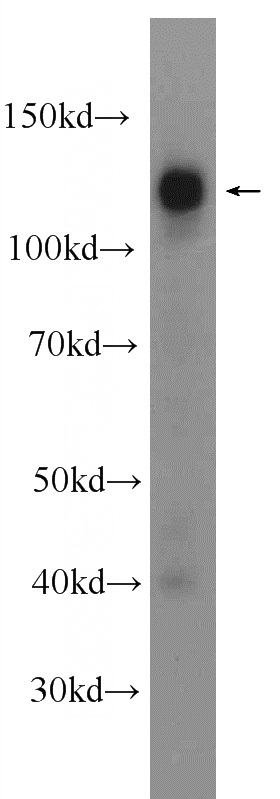 HEK-293 cells were subjected to SDS PAGE followed by western blot with Catalog No:113045(NCOA7 Antibody) at dilution of 1:1000