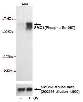 Western blot detection of SMC1(Phospho-Ser957) in Hela cells untreated or treated with UV using SMC1(Phospho-Ser957) Rabbit pAb (dilution 1:500, upper) or SMC1A Mouse mAb (200256, lower).Predicted band size:145kDa.Observed band size:145kDa.