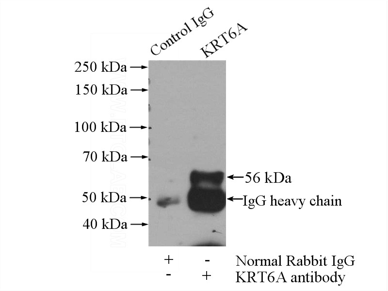 IP Result of anti-KRT6-specific (IP:Catalog No:109808, 4ug; Detection:Catalog No:109808 1:300) with HeLa cells lysate 520ug.