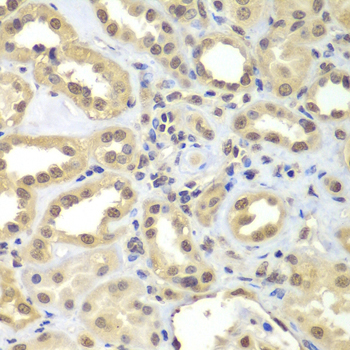 Immunohistochemistry - SUPT20H Polyclonal Antibody 