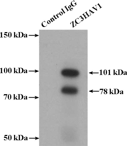 IP Result of anti-ZC3HAV1 (IP:Catalog No:116929, 4ug; Detection:Catalog No:116929 1:2000) with HeLa cells lysate 1080ug.
