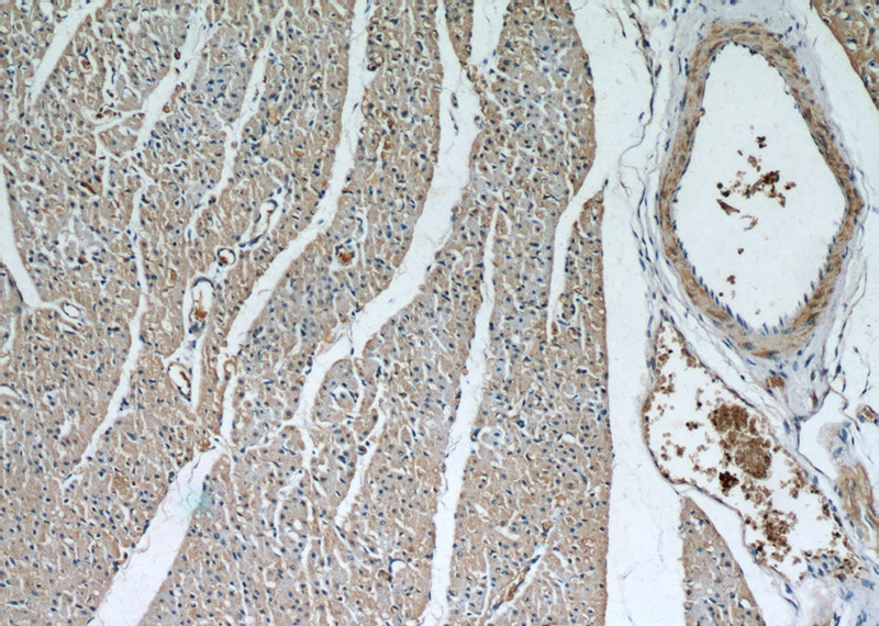 Immunohistochemical of paraffin-embedded human heart using Catalog No:112337(LRRC8C antibody) at dilution of 1:50 (under 10x lens)