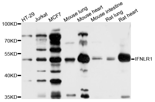 Western blot - IFNLR1 Polyclonal Antibody 