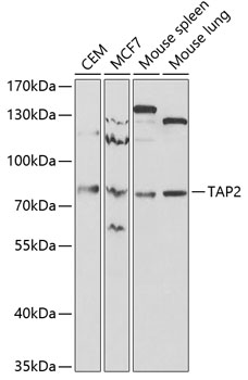 Western blot - TAP2 Polyclonal Antibody 