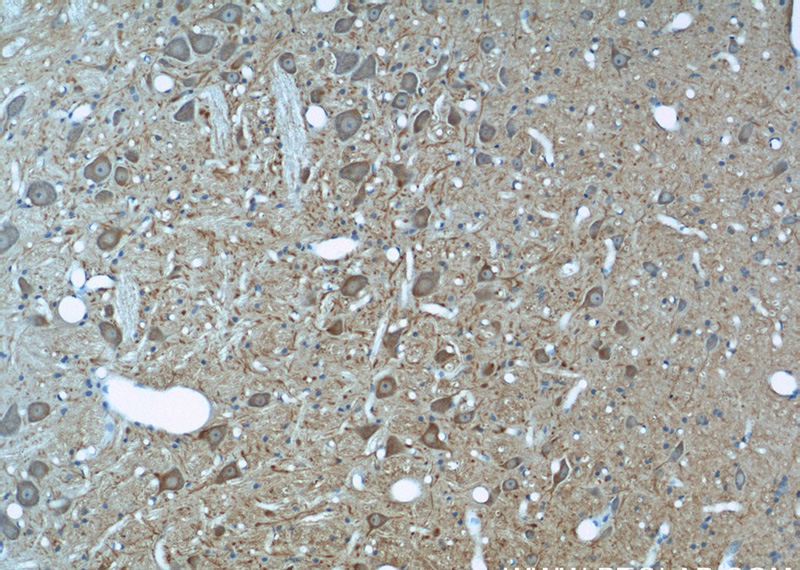 Immunohistochemical of paraffin-embedded rat brain using Catalog No:117307(tubulin-beta antibody) at dilution of 1:50 (under 10x lens)