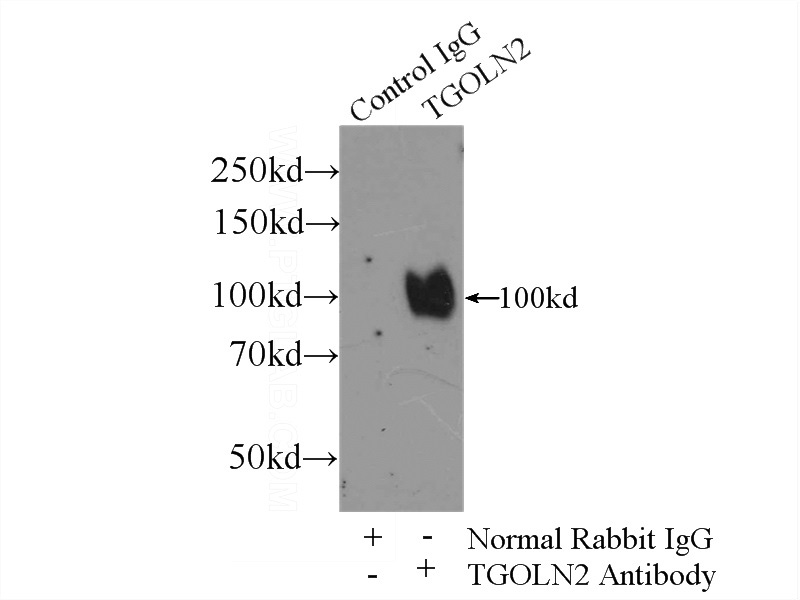 IP Result of anti-TGOLN2,TGN46 (IP:Catalog No:116032, 3ug; Detection:Catalog No:116032 1:300) with HeLa cells lysate 2400ug.