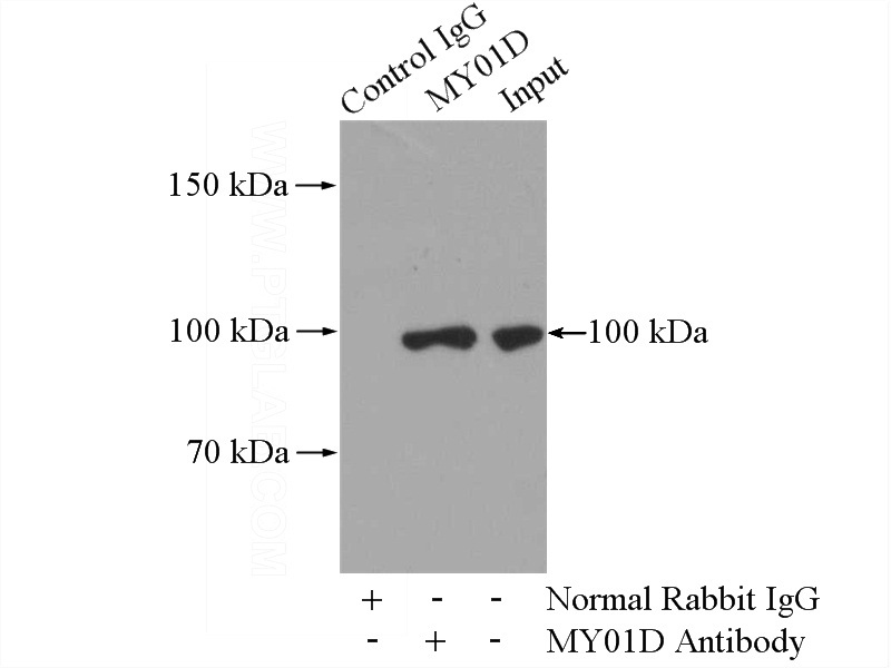 IP Result of anti-MYO1D (IP:Catalog No:112984, 4ug; Detection:Catalog No:112984 1:300) with mouse lung tissue lysate 4000ug.