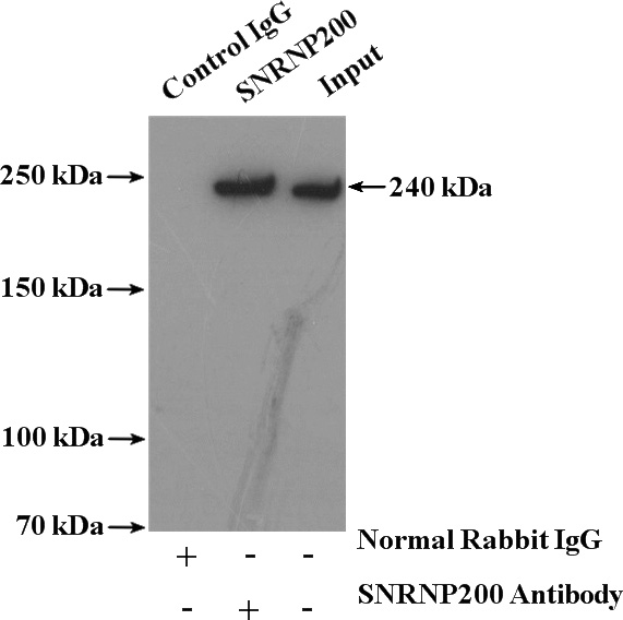 IP Result of anti-SNRNP200 (IP:Catalog No:115454, 4ug; Detection:Catalog No:115454 1:1000) with HeLa cells lysate 4000ug.
