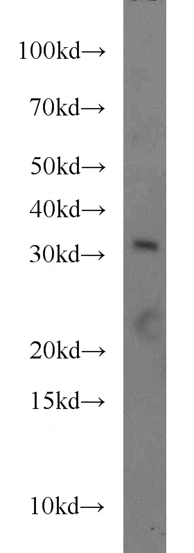 HepG2 cells were subjected to SDS PAGE followed by western blot with Catalog No:110696(FOXE3 antibody) at dilution of 1:300
