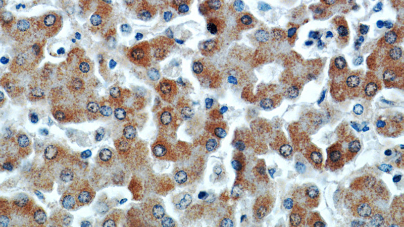 Immunohistochemical of paraffin-embedded human liver using Catalog No:113908(PIN4 antibody) at dilution of 1:50 (under 40x lens)
