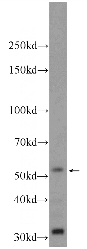HEK-293 cells were subjected to SDS PAGE followed by western blot with Catalog No:116921(ZBTB8A Antibody) at dilution of 1:1000