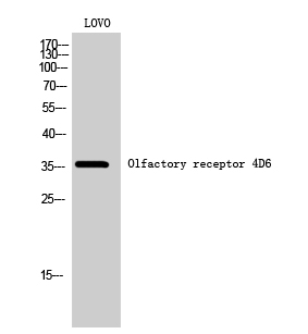 Fig1:; Western Blot analysis of LOVO cells using Olfactory receptor 4D6 Polyclonal Antibody