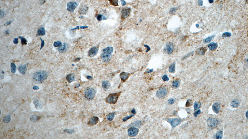 Immunohistochemistry of paraffin-embedded human brain tissue slide using Catalog No:109208(CHAT Antibody) at dilution of 1:50 (under 40x lens)