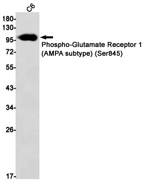 Western blot detection of Phospho-Glutamate Receptor 1 (AMPA subtype) (Ser845) in C6 cell lysates using Phospho-Glutamate Receptor 1 (AMPA subtype) (Ser845) Rabbit mAb(1:1000 diluted).Predicted band size:102kDa.Observed band size:102kDa.