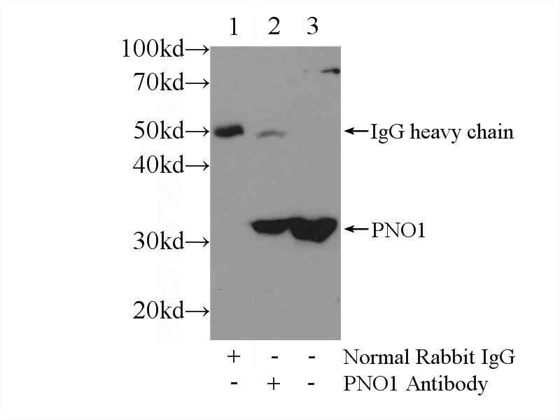 IP Result of anti-PNO1 (IP:Catalog No:113980, 3ug; Detection:Catalog No:113980 1:300) with L02 cells lysate 1500ug.